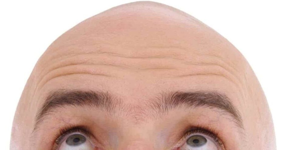 Gran Bretagna: definire un uomo pelato è molestia sessuale