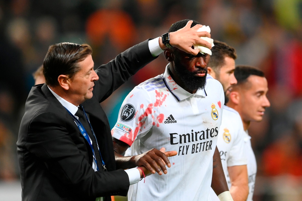 Rudiger, l'1-1 gli costa una maschera di sangue