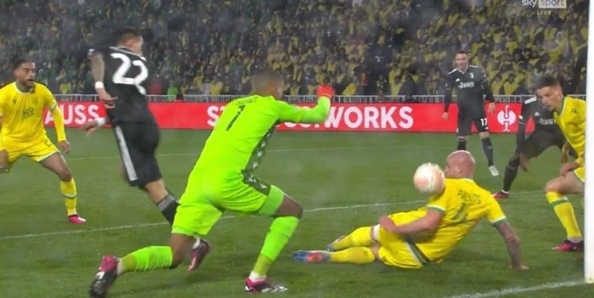 Nantes-Juve, espulsione da DOGSO: vi spieghiamo perché