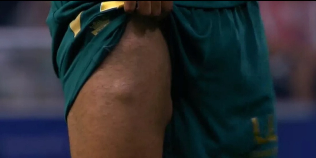 Liga, l’immagine shock diventata virale: alza i pantaloncini e…