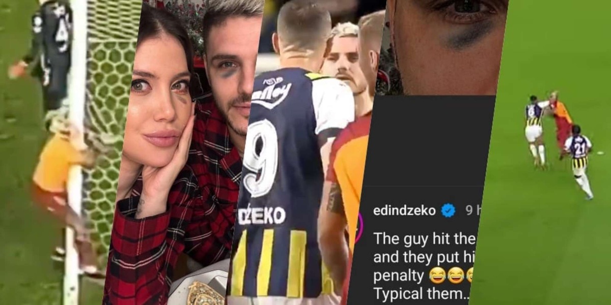 Icardi, occhio nero in Fenerbahce-Galatasaray: foto con Wanda Nara virale, Dzeko risponde così