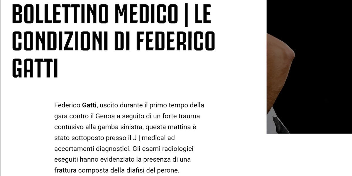 Juve, gli esami non sorridono a Gatti: c'è frattura