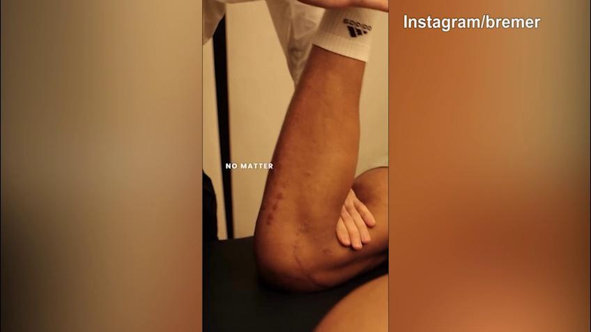 Juve, Bremer non si ferma un attimo e lancia messaggi social