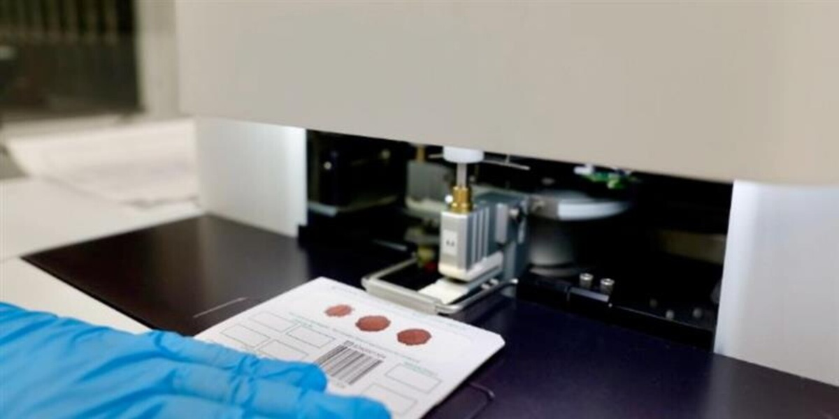 Giornata Mondiale della Fibrosi Cistica: con Genoma Puglia la diagnosi precoce diventa realtà, scoperti oltre 5 casi nei neonati