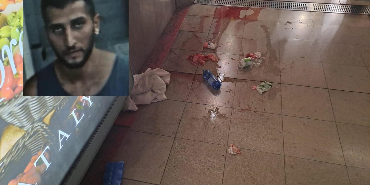 Ragazza sfregiata a Milano, 'ho pensato di morire'