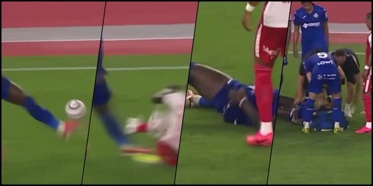 Intervento durissimo e ginocchio rotto in più parti: stagione a rischio per il giocatore della Liga