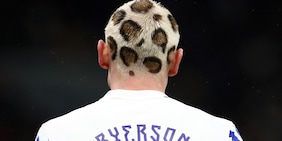 Contro l'Italia con i capelli maculati: il look di Ryerson è virale sul web