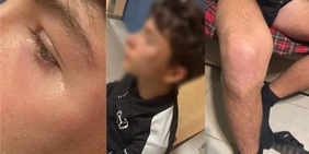 Arbitro minorenne aggredito in Puglia, altro episodio shock. L'Aia: "Siamo soli"