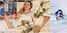 Vonn, incubo senza fine. Terza operazione chirurgica: la foto dall’ospedale è impressionante