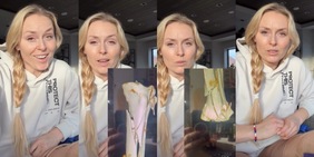 Lindsey Vonn dimessa dall'ospedale: "Così ho rischiato di perdere la gamba, la strada è ancora lunga"