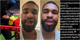 Trauma facciale per Loftus-Cheek, intervento ok ma foto shock sui social: per quanto lo perde il Milan