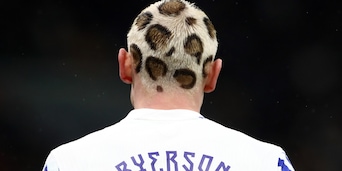 Contro l'Italia con i capelli maculati: il look di Ryerson è virale sul web