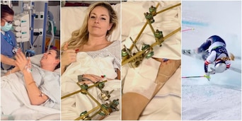 Vonn, incubo senza fine. Terza operazione chirurgica: la foto dall’ospedale è impressionante