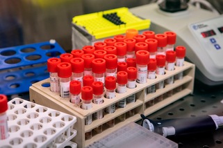 Coronavirus, i dati aggiornati in Italia: 148 morti e 3.296 malati