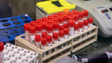 Coronavirus, i dati aggiornati in Italia: 148 morti e 3.296 malati