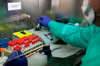 Abruzzo, Coronavirus: due nuovi casi positivi