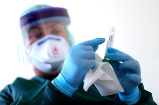 Coronavirus: ecco il vaccino S-Spike. Test sui topi in Australia