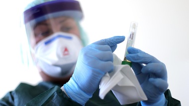 Coronavirus: ecco il vaccino S-Spike. Test sui topi in Australia