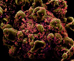 Dagli Usa: "Il Coronavirus circolava da anni"