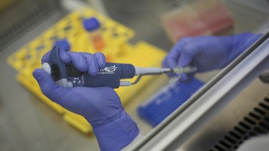 Coronavirus, il farmaco Tocilizumab su 100 malati: il 77% è migliorato