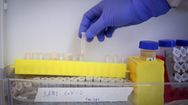 Ricciardi: "Il Coronavirus frenerà a giugno per due motivi"