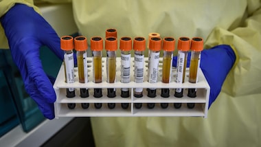 "Il Coronavirus si sta adattando all'uomo"