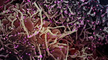 Coronavirus, trovate 14 mutazioni: una quella dominante