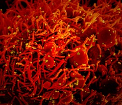 Coronavirus, in Italia circolava da prima dell'epidemia: ecco la conferma