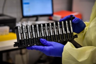 Coronavirus, i dati in Italia: 262 morti nelle ultime 24 ore