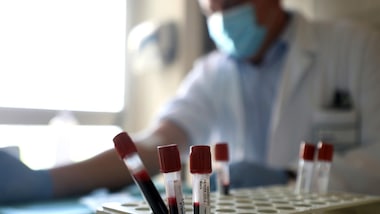 Coronavirus, la privacy rallenta i test sierologici