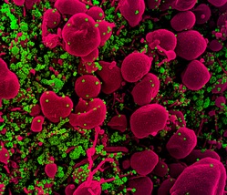 Dagli Usa: "Coronavirus, scoperto il collegamento con la sindrome di Kawasaki"