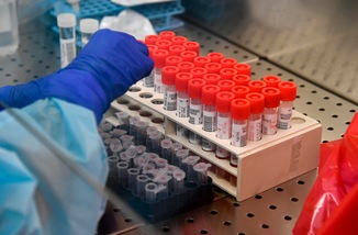 Coronavirus, l'Oms avvisa i fumatori: alta mortalità e sintomi gravi