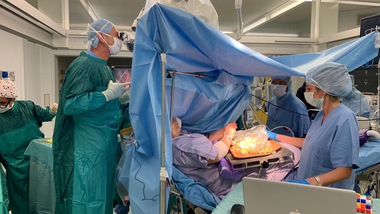 Una donna prepara 90 olive ascolane mentre viene operata al cervello