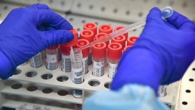 Coronavirus, Gimbe avverte: "Meno 12,6% di tamponi, la strategia è sbagliata"