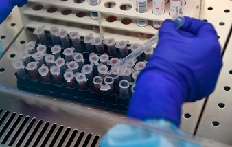 Coronavirus, a Parigi quarto caso di trasmissione in utero