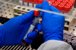 Coronavirus, registrati altri casi positivi a Pechino