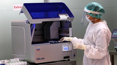 "Coronavirus, l'idrossiclorochina riduce la mortalità"