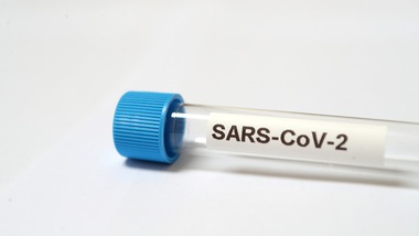 "Eparina, ecco l'arma per neutralizzare il Coronavirus"