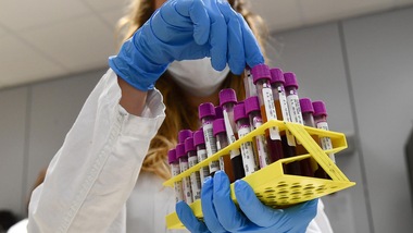 Il Coronavirus può essere sconfitto dai raggi Uv