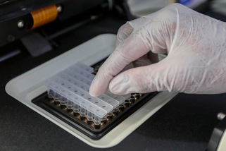 Dalla Gran Bretagna: "Coronavirus, ecco il farmaco della svolta"