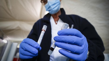 Coronavirus, boom di guariti in Italia: 269 rispetto a ieri