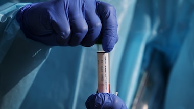 Coronavirus, in Italia scende il numero dei nuovi decessi: nove in 24 ore