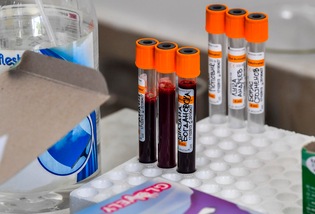 Coronavirus, morto il medico della Nazionale ucraina