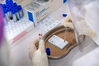 Coronavirus, in Italia 12 morti in un giorno. 159 i nuovi positivi