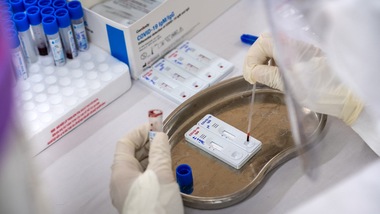 Coronavirus, in Italia 12 morti in un giorno. 159 i nuovi positivi