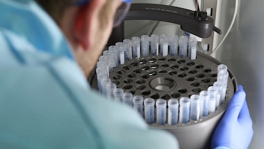 Coronavirus, dalla Cina: "L'immunità dura solo un mese"