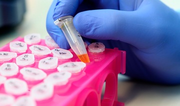 Coronavirus, esperti mondiali su vaccino russo: "Decisione folle"