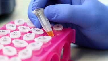 Coronavirus, esperti mondiali su vaccino russo: "Decisione folle"