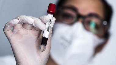 Coronavirus, contagi in aumento: 11 morti e 1.733 nuovi casi