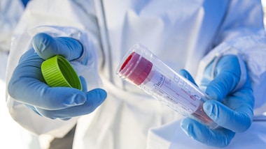 Napoli, focolaio Coronavirus in Rsa: 48 positivi su 225 tamponi